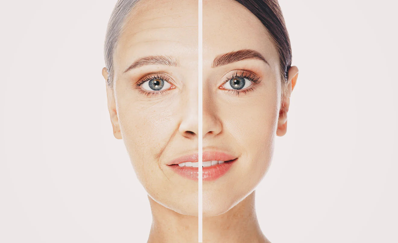 Level 6 In Foundation Dermal Fiilers